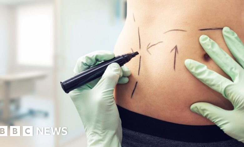 119543096 getty655746186 lipo