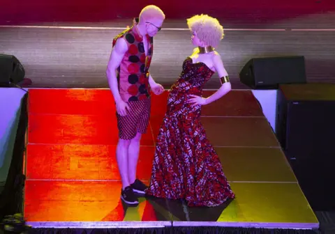 AARON UFUMELI/EPA Contestants from Angola pose during the "Mr and Miss Albinism Southern Africa 2023" beauty pageant at the Harare International Conference Centre, in Harare, Zimbabwe, 14 October 2023 (issued 15 October 2023). The pageant, the first of its kind in the world, was held to conscientise the world that people with albinism are the same as every other person, remove stigma and also to end the discrimination and the ritual killings of albinos particularly in Africa.